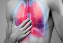 سندرم دیسترس تنفسی و نارسایی تنفسی حاد ناشی از تنفس بخار THC | اطلاعات پزشکی طب لاین