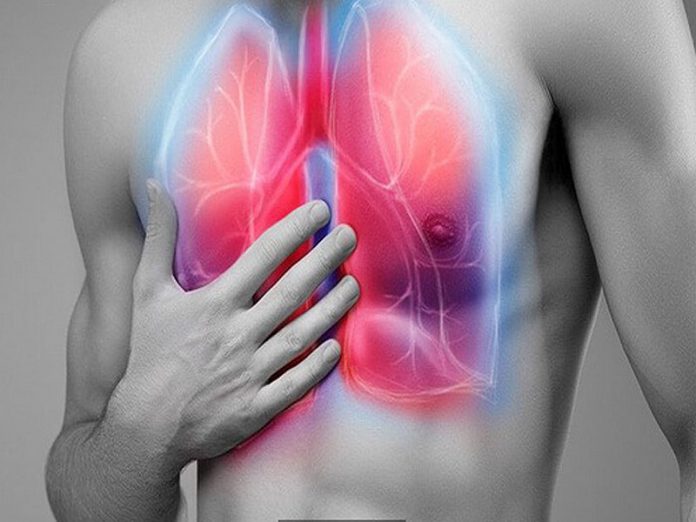 سندرم دیسترس تنفسی و نارسایی تنفسی حاد ناشی از تنفس بخار THC | اطلاعات پزشکی طب لاین