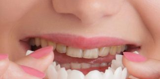 زیبایی دندان - دندانپزشک - پرستاری - گروه علوم - کادر درمان پزشکی