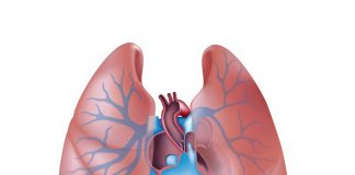 بیماری ریوی - گروه کادر درمان پرستاری و متخصصین علوم پزشکی و داروشناسی طب لاین - خون - کاهش اکسیژن خون - نارسایی سمت چپ قلب