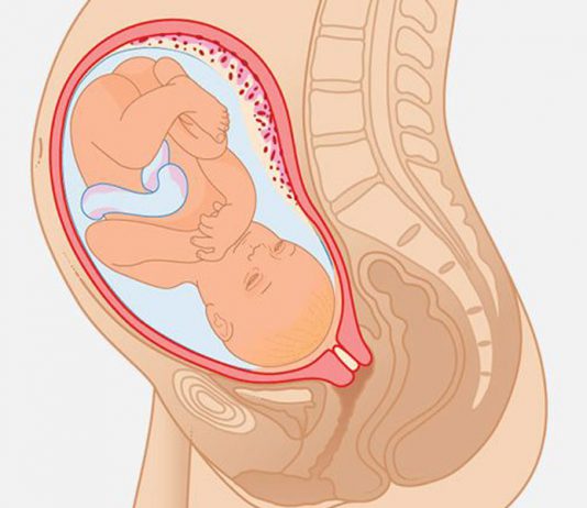 پزشکی قرص - مقایسه تاثیر میزوپروستول و دینوپروستون در زایمان حاملگی