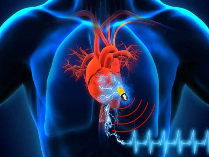 پیس میکریا ضربان ساز قلب | اندیکاسیون پیس میکر و دیس ریتمی | اطلاعات پزشکی طب لاین