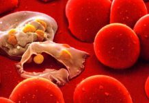 عفونت خون - درمان - گروه کادر درمان پرستاری و پزشکی طب لاین
