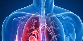 پنوموتوراکس - ادم ریه-دیسترس تنفسی-پرده جنب -علائم و درمان بیماری ریوی