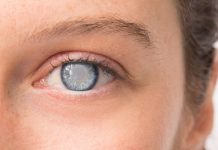 کاتاراکت cataract (آب مروارید چشم) - پرستاری - پزشکی - گوش و حلق و بینی - درمان