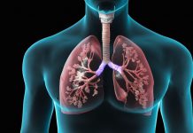 بیماری‎ های ریه و تنفس - کادر درمان - مشکلات تنفسی - پزشکی