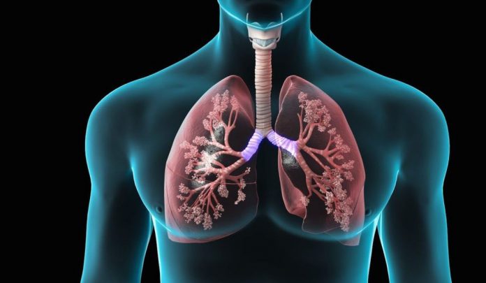 بیماری‎ های ریه و تنفس - کادر درمان - مشکلات تنفسی - پزشکی