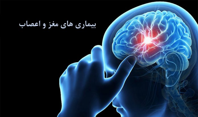 درمان - پزشکی - مغز و اعصاب - نورولوژیست - متخصص مغز و اعصاب