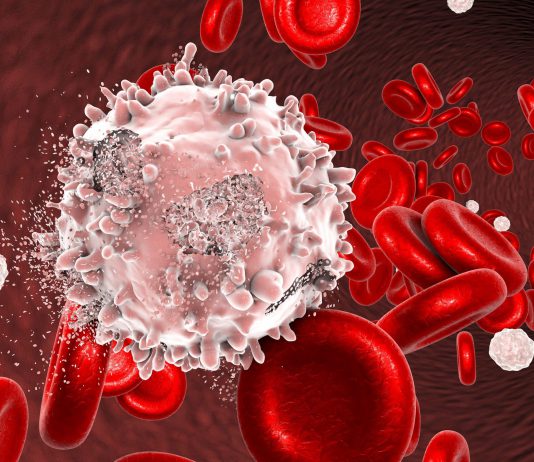 بیماری سرطان خون - پزشکی - علوم پزشکی طب لاین - پرستاری - سلول‌ های خونی - بیماری سرطان خون