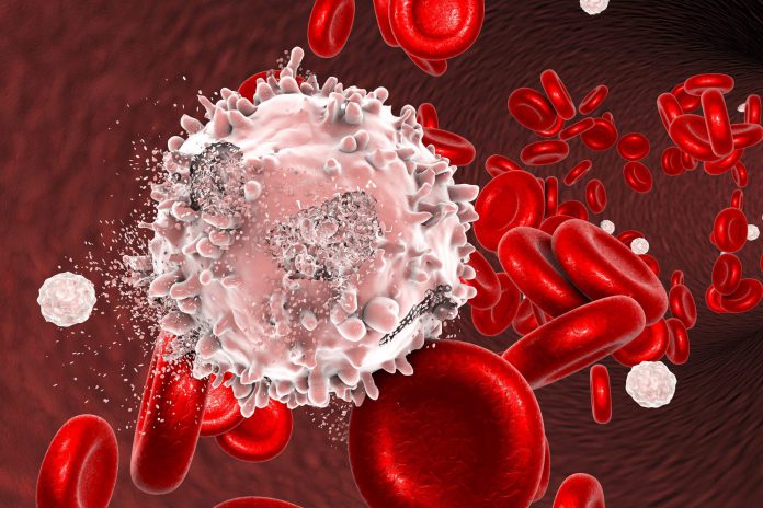 بیماری سرطان خون - پزشکی - علوم پزشکی طب لاین - پرستاری - سلول‌ های خونی - بیماری سرطان خون