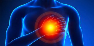آنژین یا حملات قلبی - احساس فشار در قفسه سینه - آنژین یا حملات قلبی