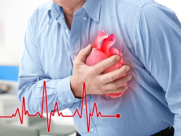 علائم حمله قلبی - قفسه سینه - قلب - پزشکی - بیماری - علائم حمله قلبی