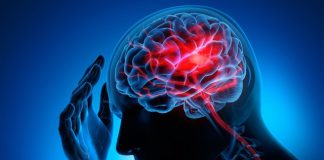 فیزیوتراپی سکته مغزی - متخصصین علوم پزشکی - آسیب‌های عروقی مغز
