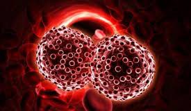 علائم سرطان خون -شیمی درمانی-لنفوسیت ها - سلول های خونی