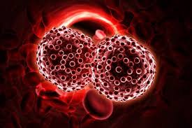 علائم سرطان خون - پزشکی طب لاین - پرستاری - سلول های خونی