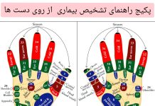 راهنمای تشخیص بیماری از طریق دست ها - طب سنتی - طب ایرانی - علم سوجوک