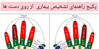راهنمای تشخیص بیماری از طریق دست ها - طب سنتی - طب ایرانی - علم سوجوک